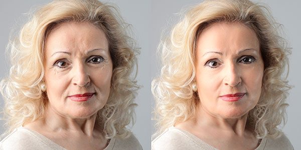 managing skin changes during menopause 2