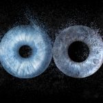 Everything in view: high-resolution retinal maps help diagnose diseases